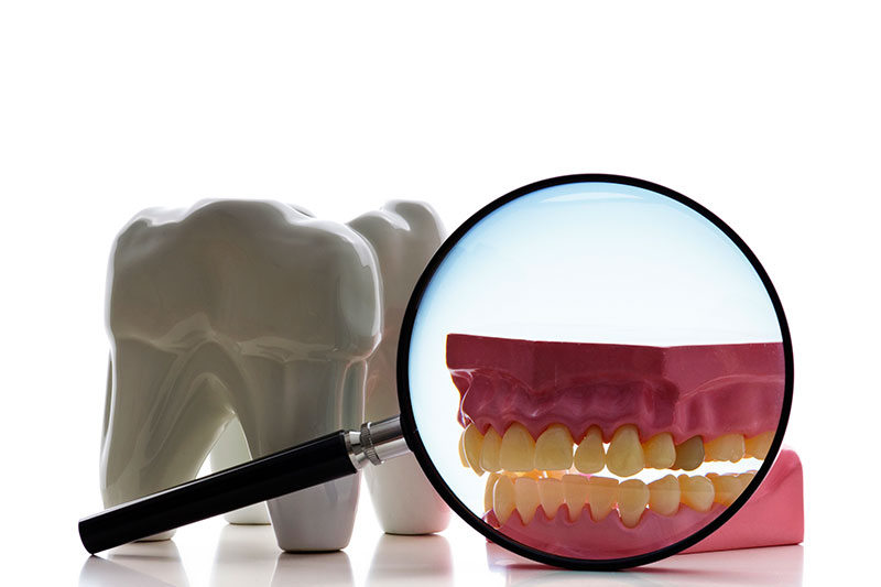 Dentist in Kingsburg CA, Dental Implants and Cosmetic Dentistry 93631|Root Canal