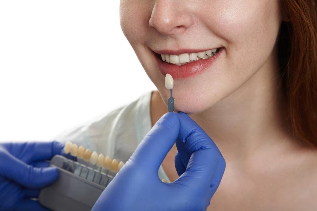 veneer for one tooth